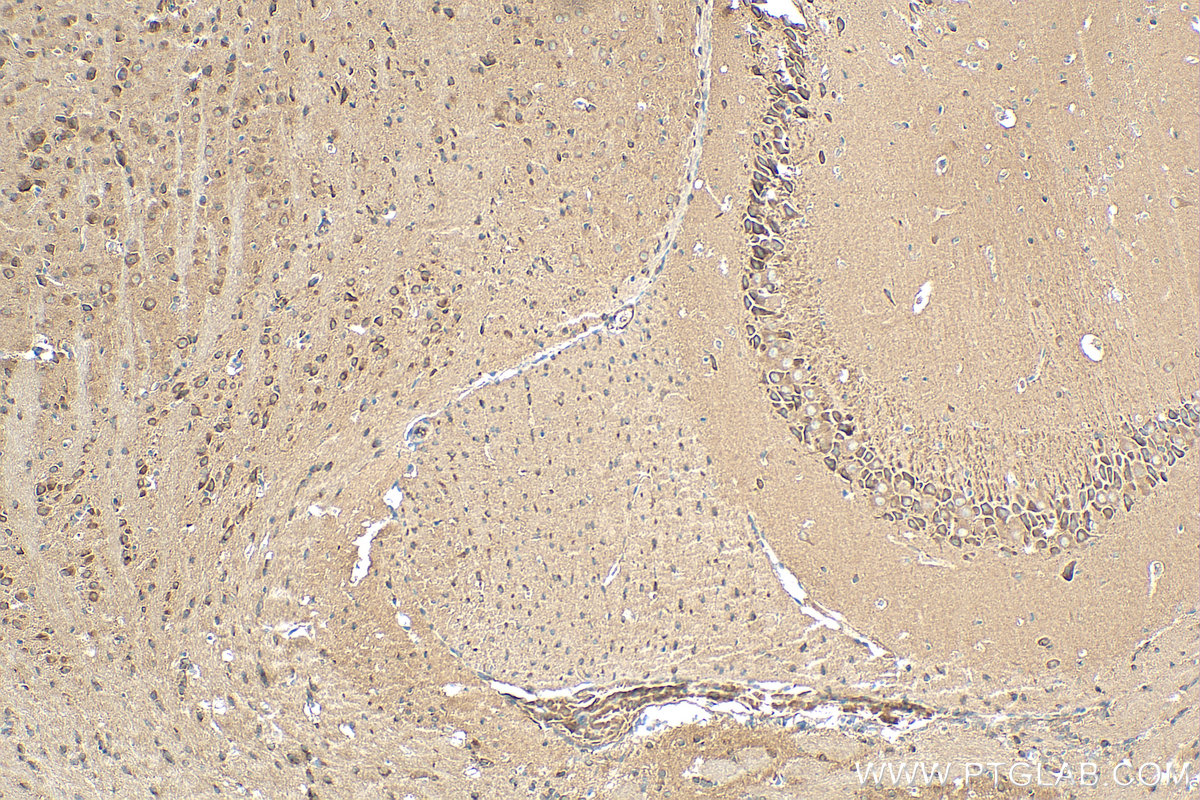 IHC staining of mouse brain using 21624-1-AP