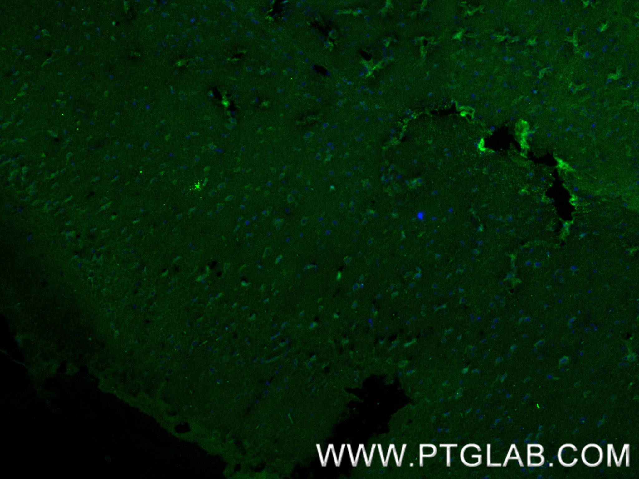 IF Staining of mouse brain using 85058-4-RR