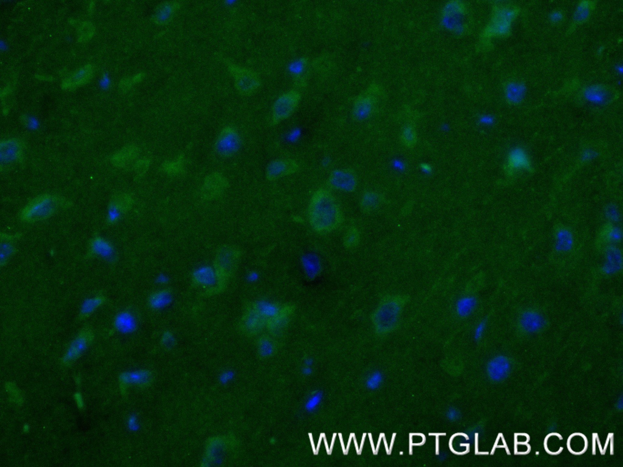 IF Staining of mouse brain using 85058-4-RR