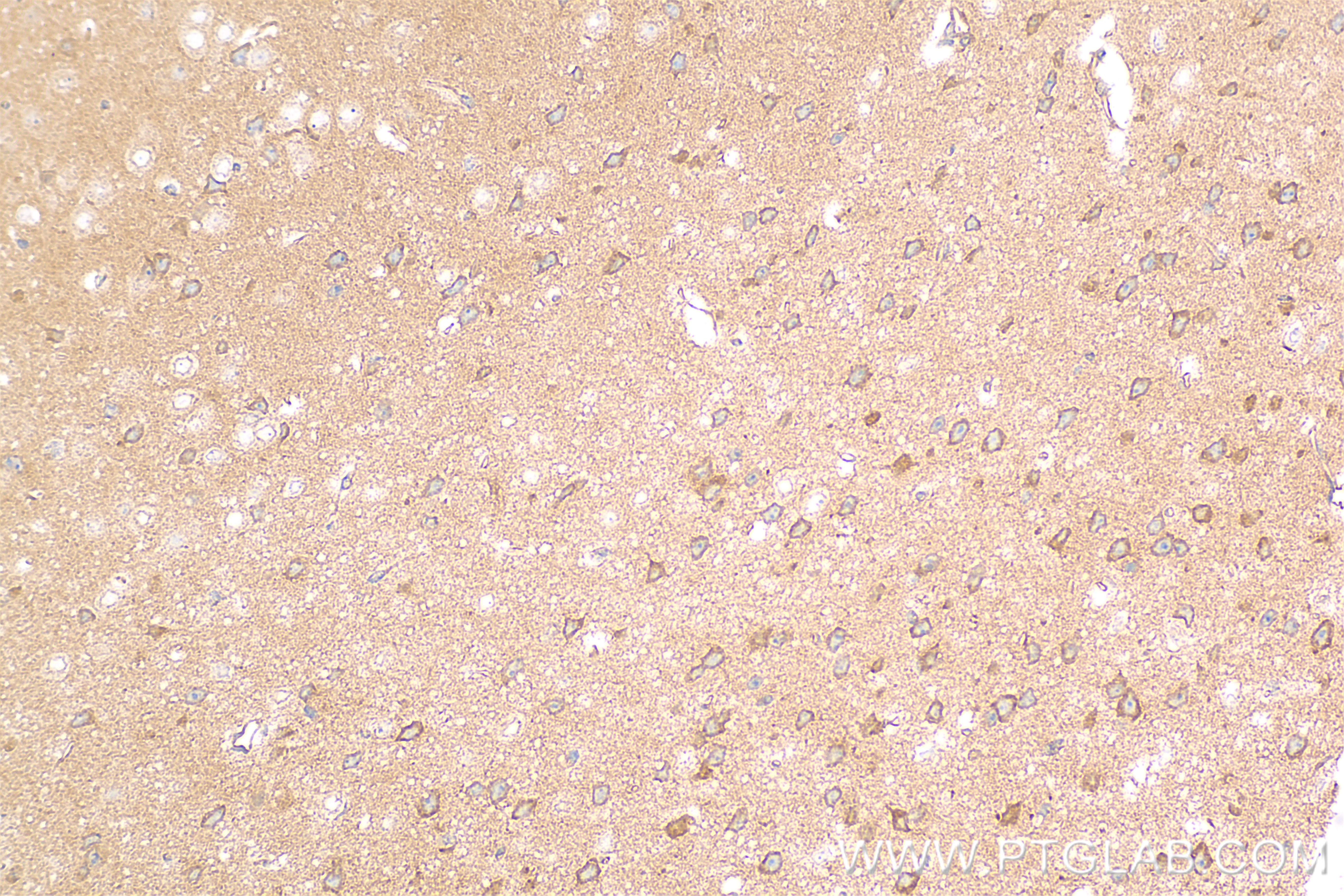 IHC staining of mouse brain using 85058-4-RR