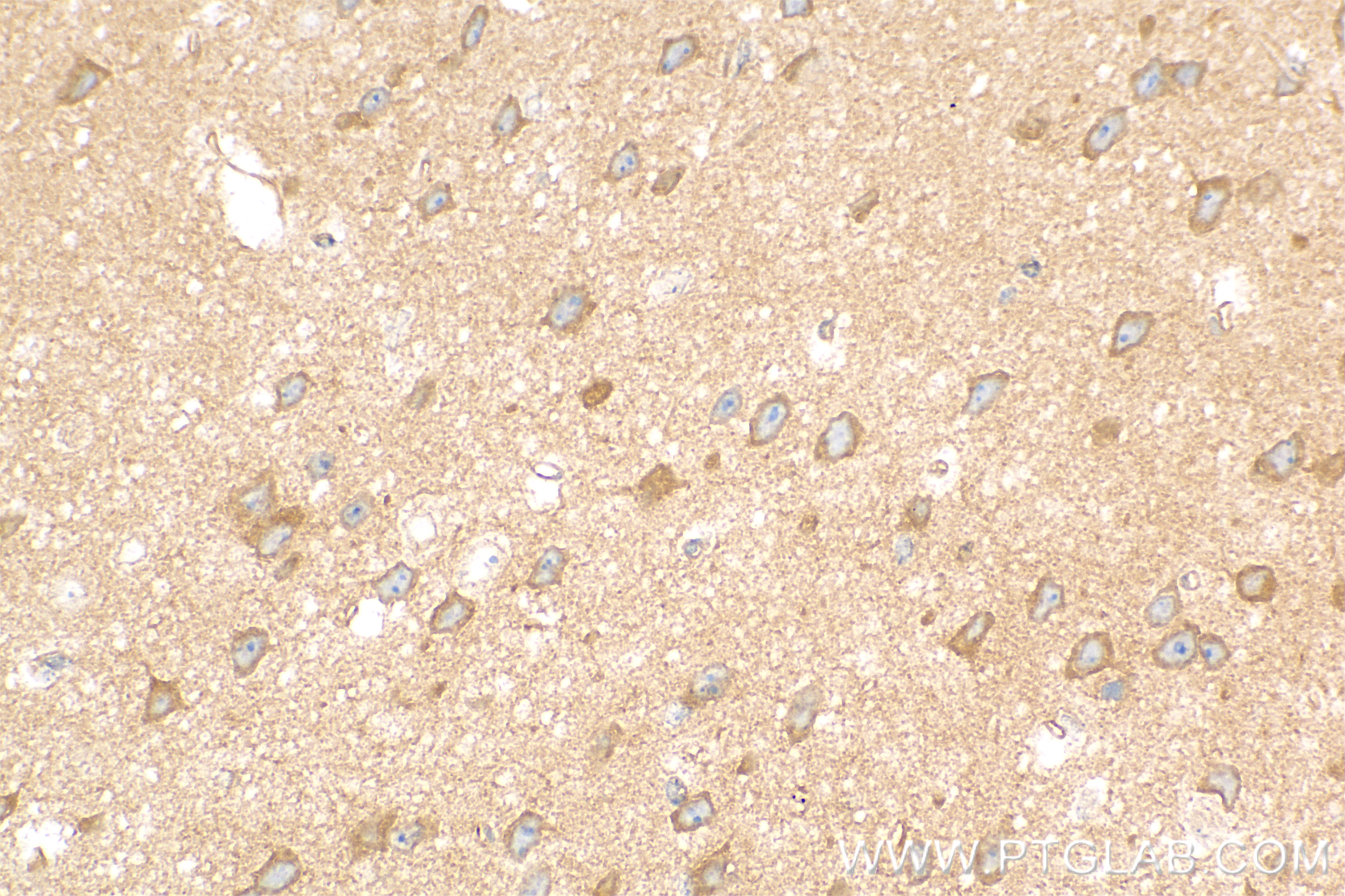 IHC staining of mouse brain using 85058-4-RR