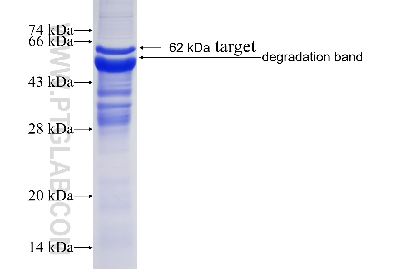 STS fusion protein Ag12353 SDS-PAGE