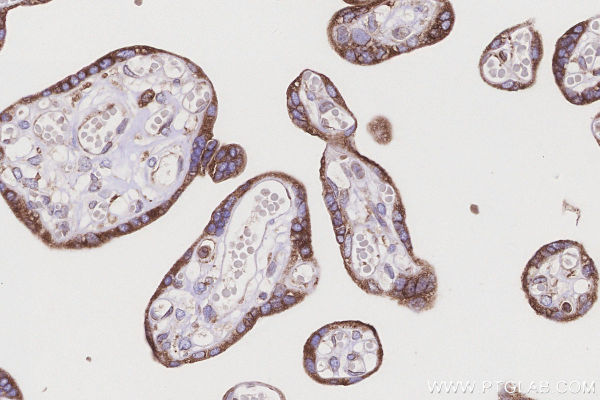 IHC staining of human placenta using 66581-1-Ig IHC staining of human placenta using 66581-1-Ig