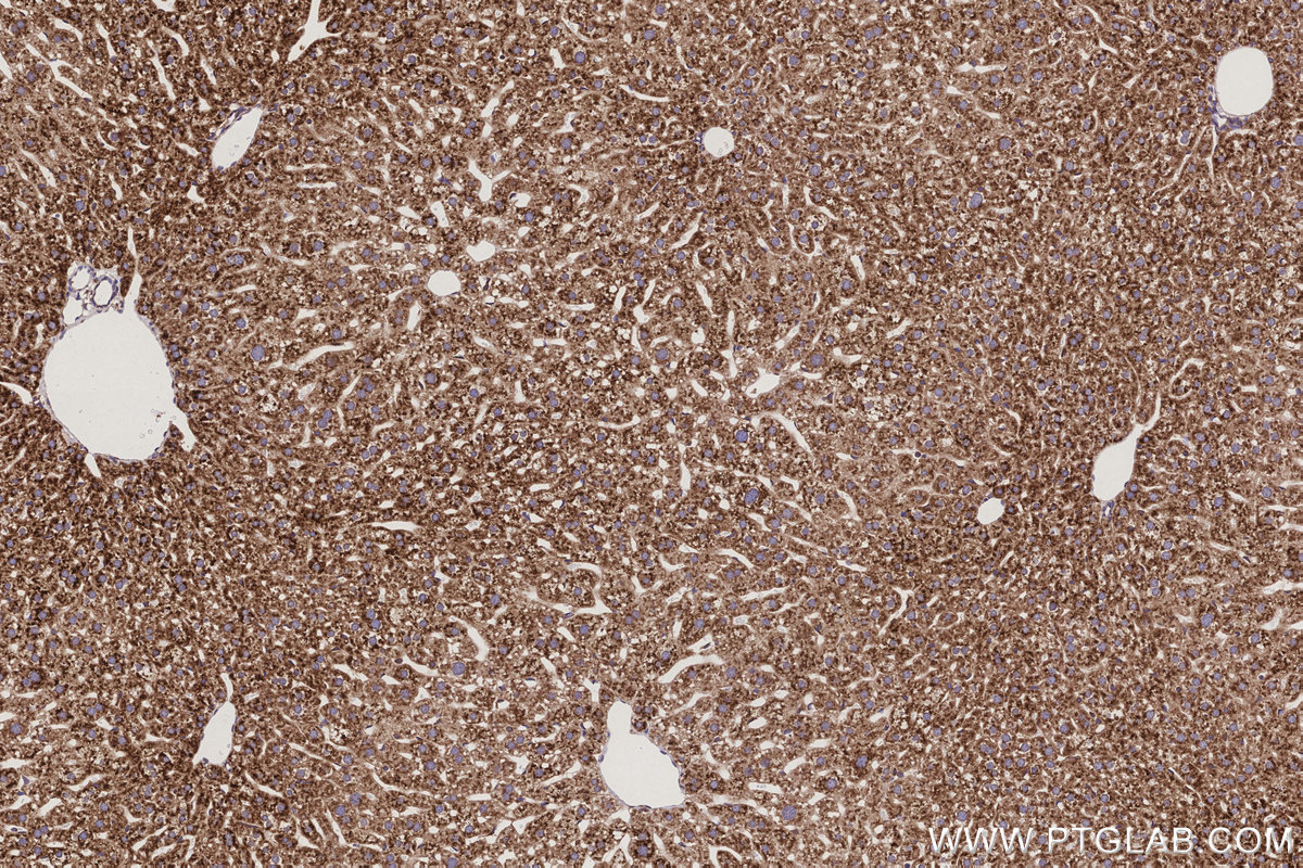 IHC staining of mouse liver using 66581-1-Ig IHC staining of mouse liver using 66581-1-Ig