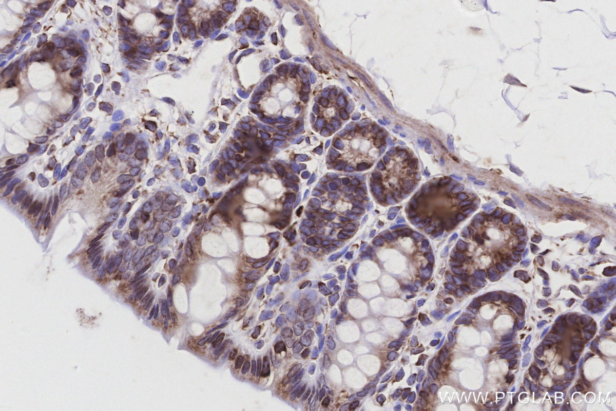 IHC staining of rat colon using 66581-1-Ig IHC staining of rat colon using 66581-1-Ig