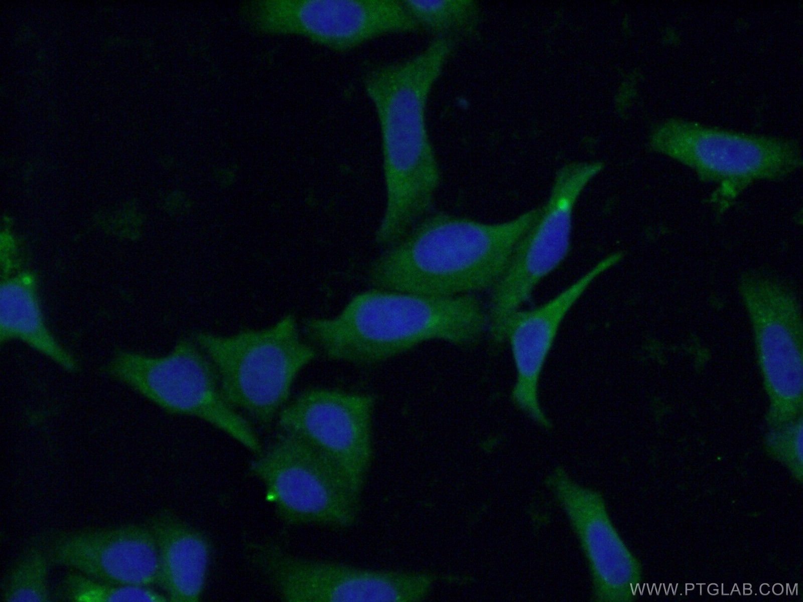 IF Staining of HepG2 using 15323-1-AP