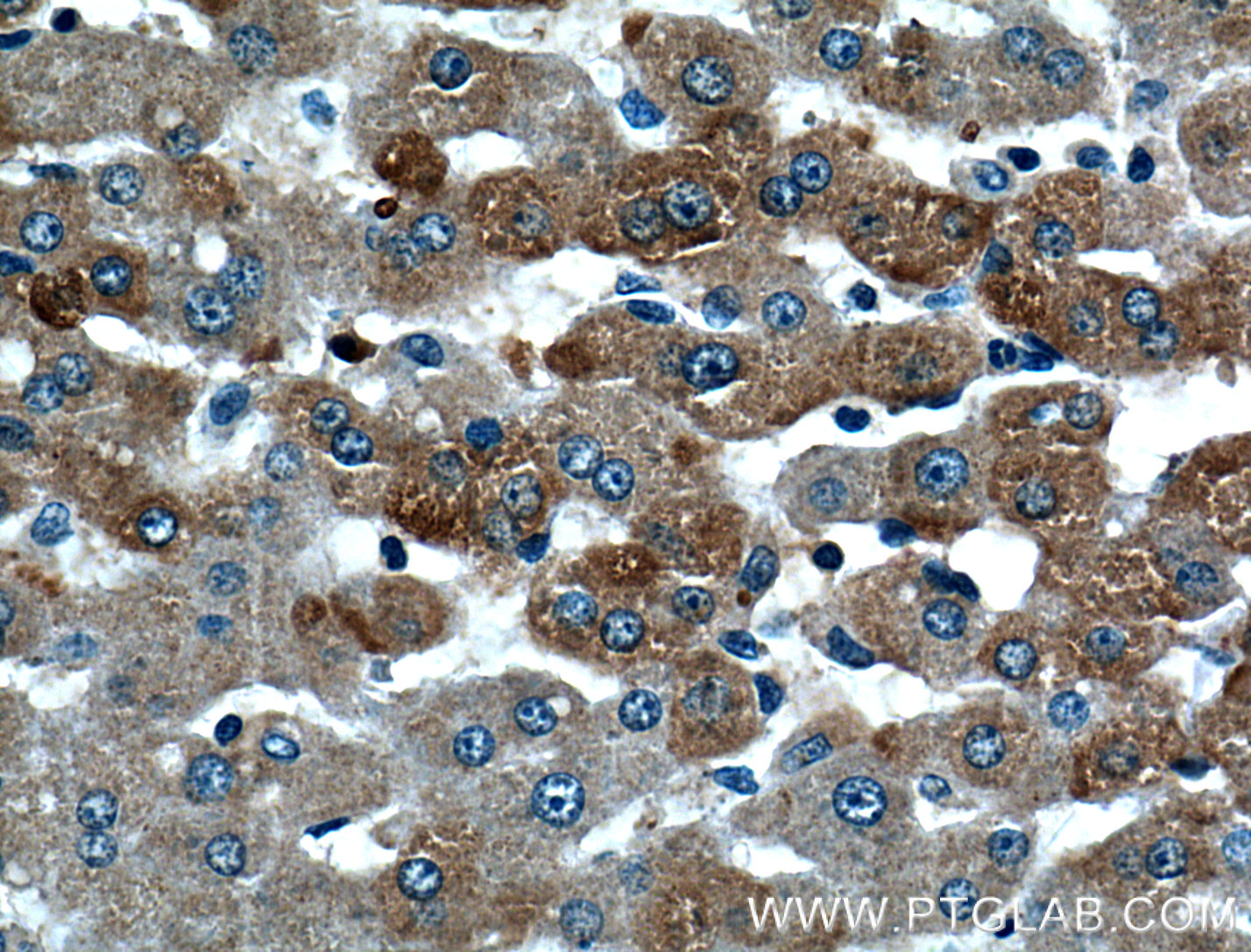 STT3B Polyclonal antibody