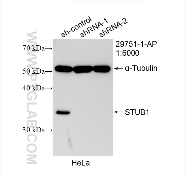 WB analysis of HeLa using 29751-1-AP