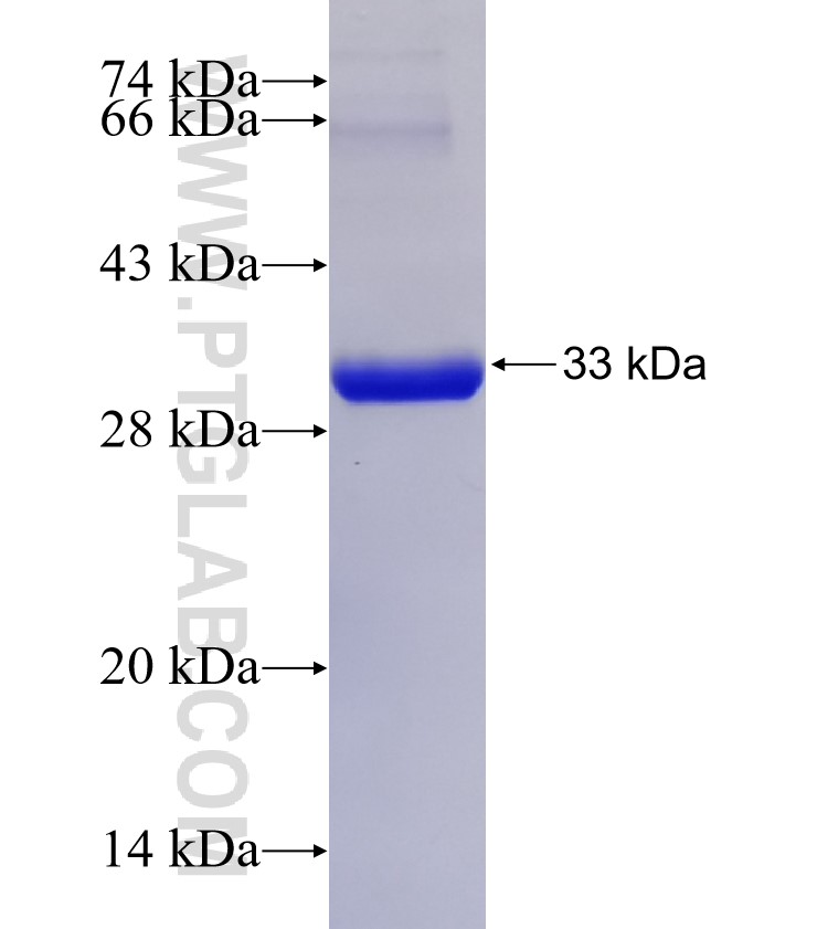 STUB1 fusion protein Ag31348 SDS-PAGE