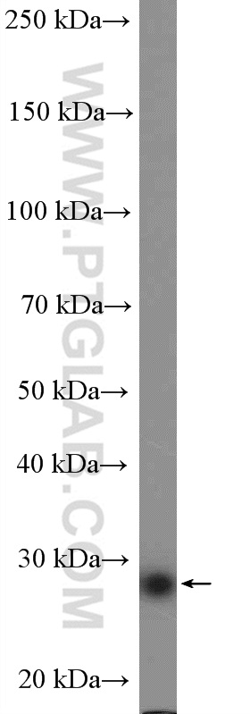 WB analysis of HeLa using 11036-1-AP