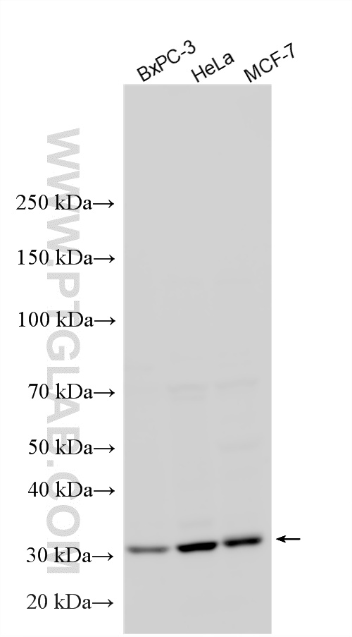 WB analysis using 11036-1-AP WB analysis using 11036-1-AP