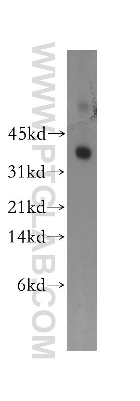 WB analysis of human placenta using 13301-1-AP