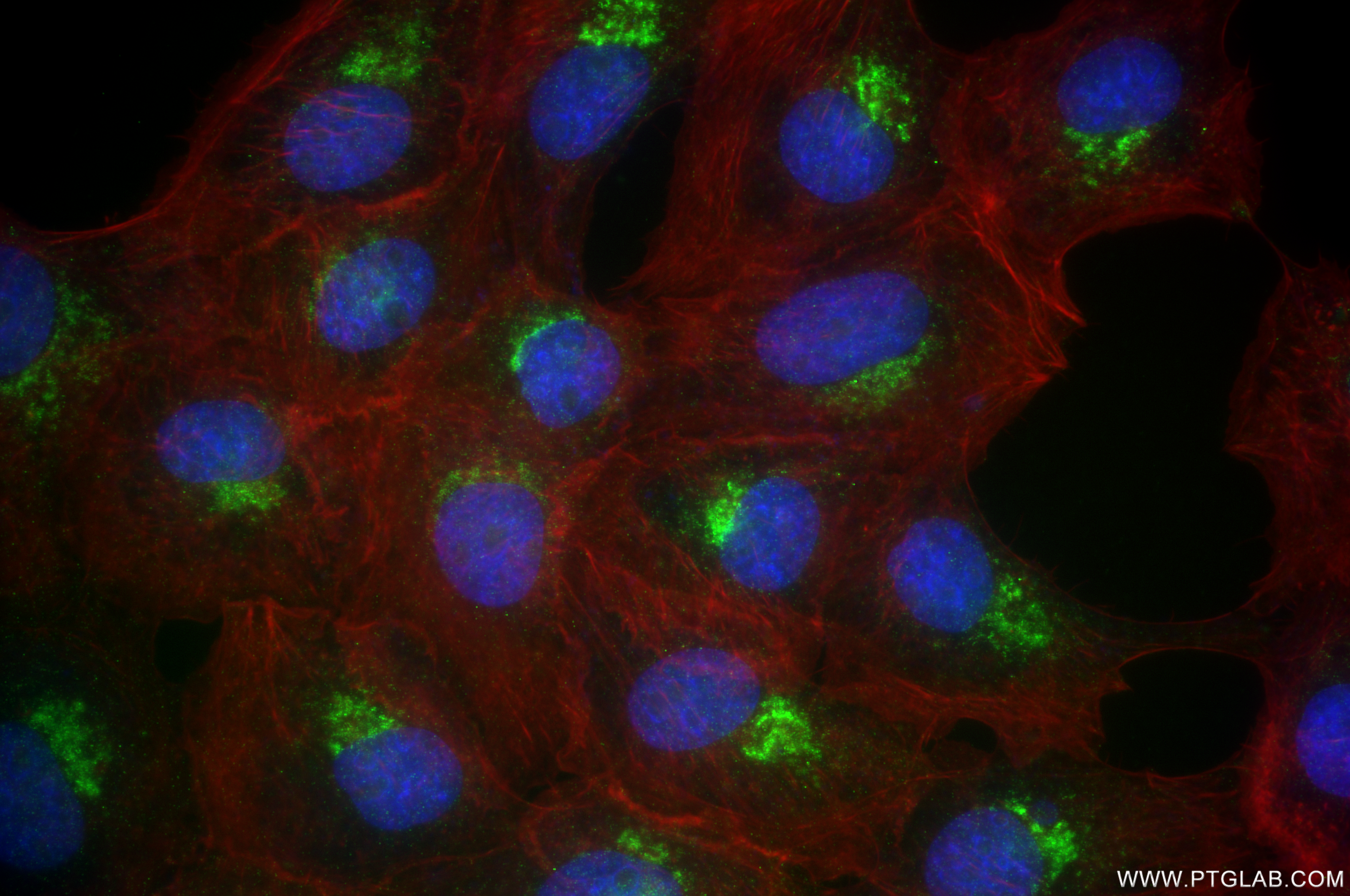 IF Staining of A431 using 85069-4-RR (same clone as 85069-4-PBS)
