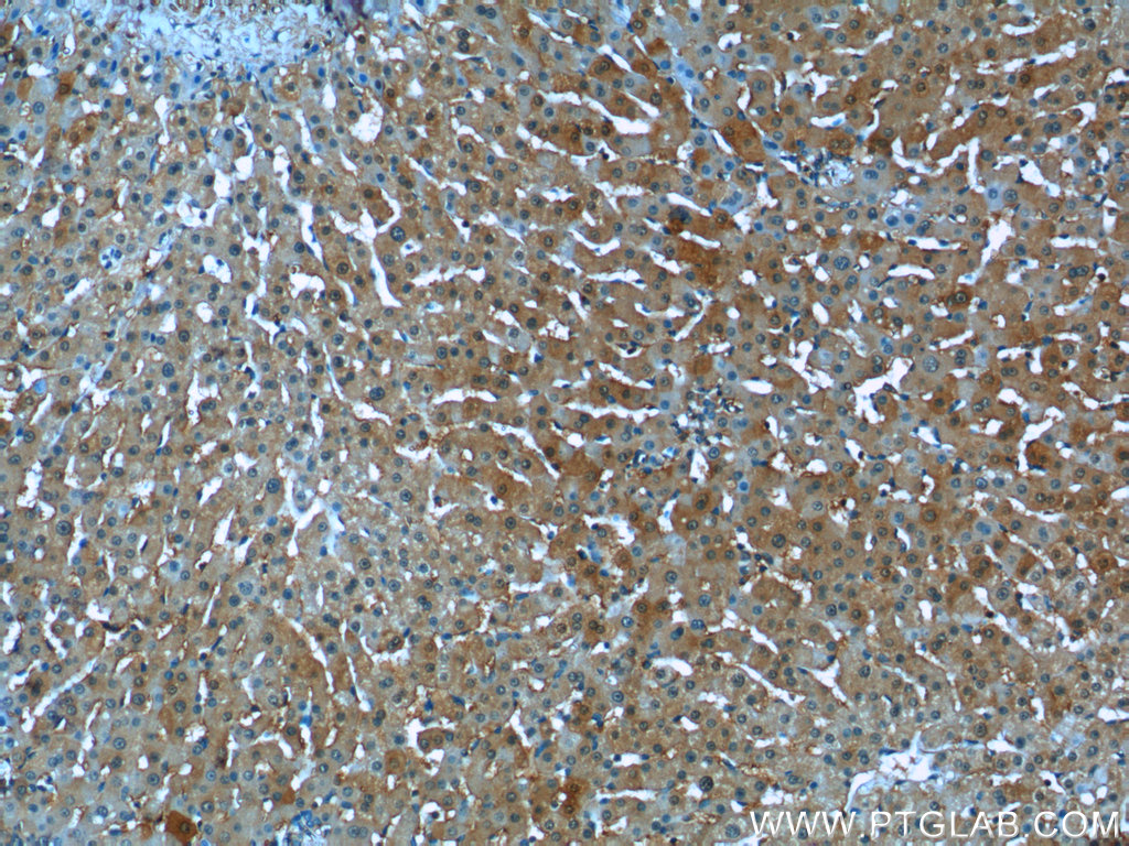 IHC staining of human liver using 17815-1-AP