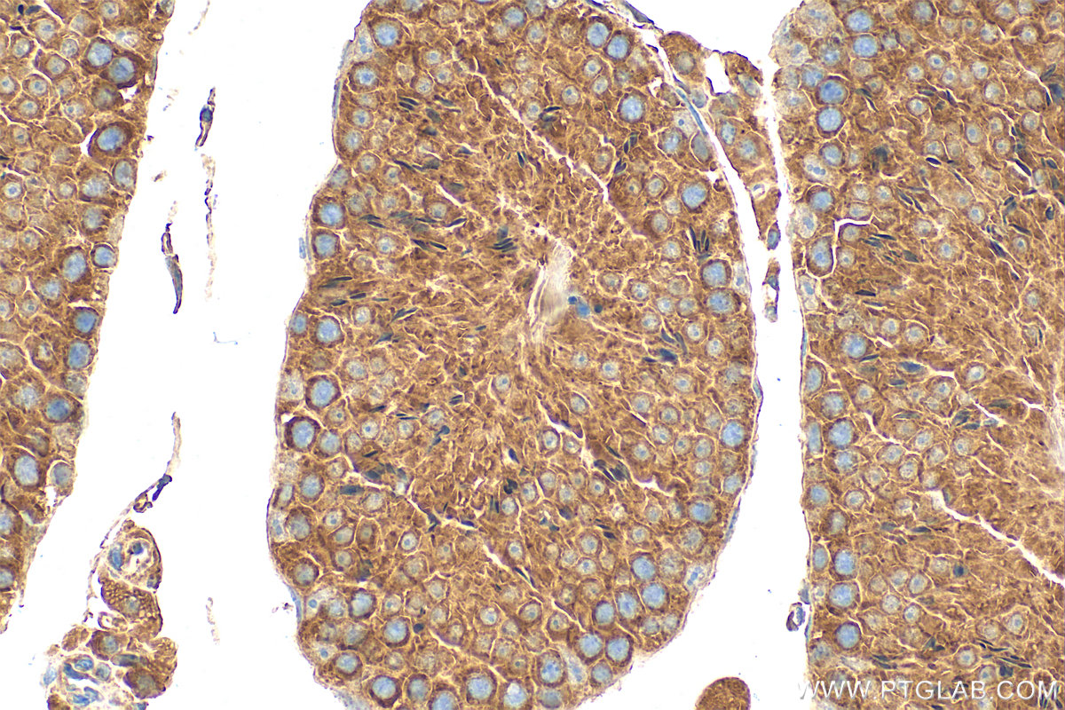 IHC staining of mouse testis using 17815-1-AP