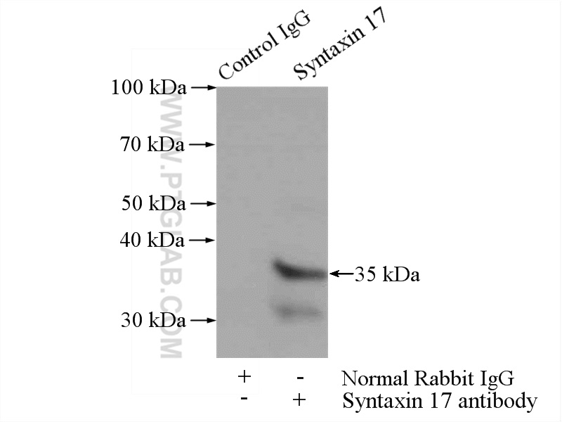 IP experiment of HepG2 using 17815-1-AP