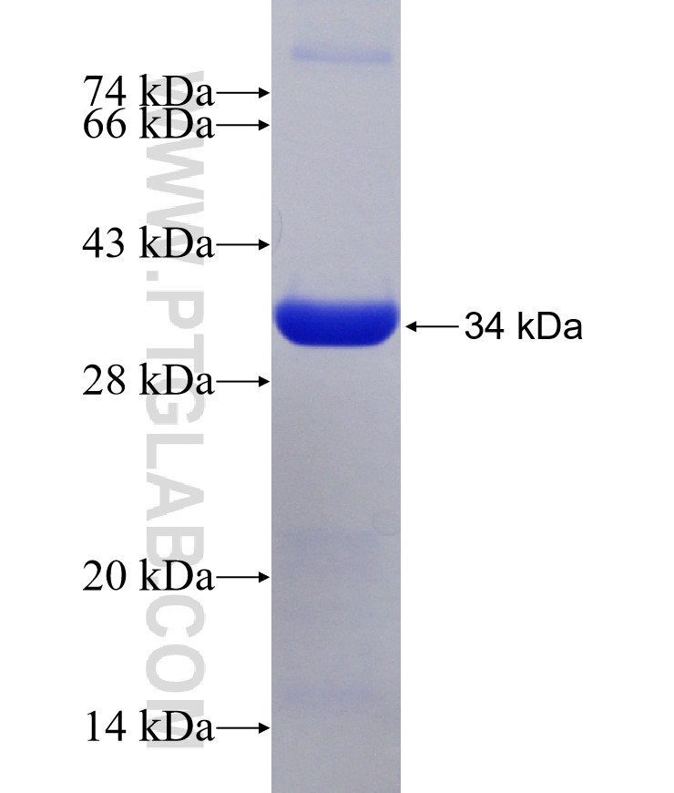 STX17 fusion protein Ag12378 SDS-PAGE