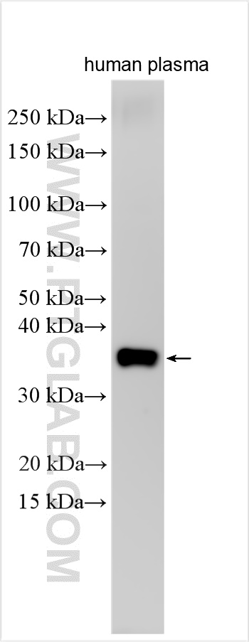 WB analysis of human plasma using 55164-1-AP