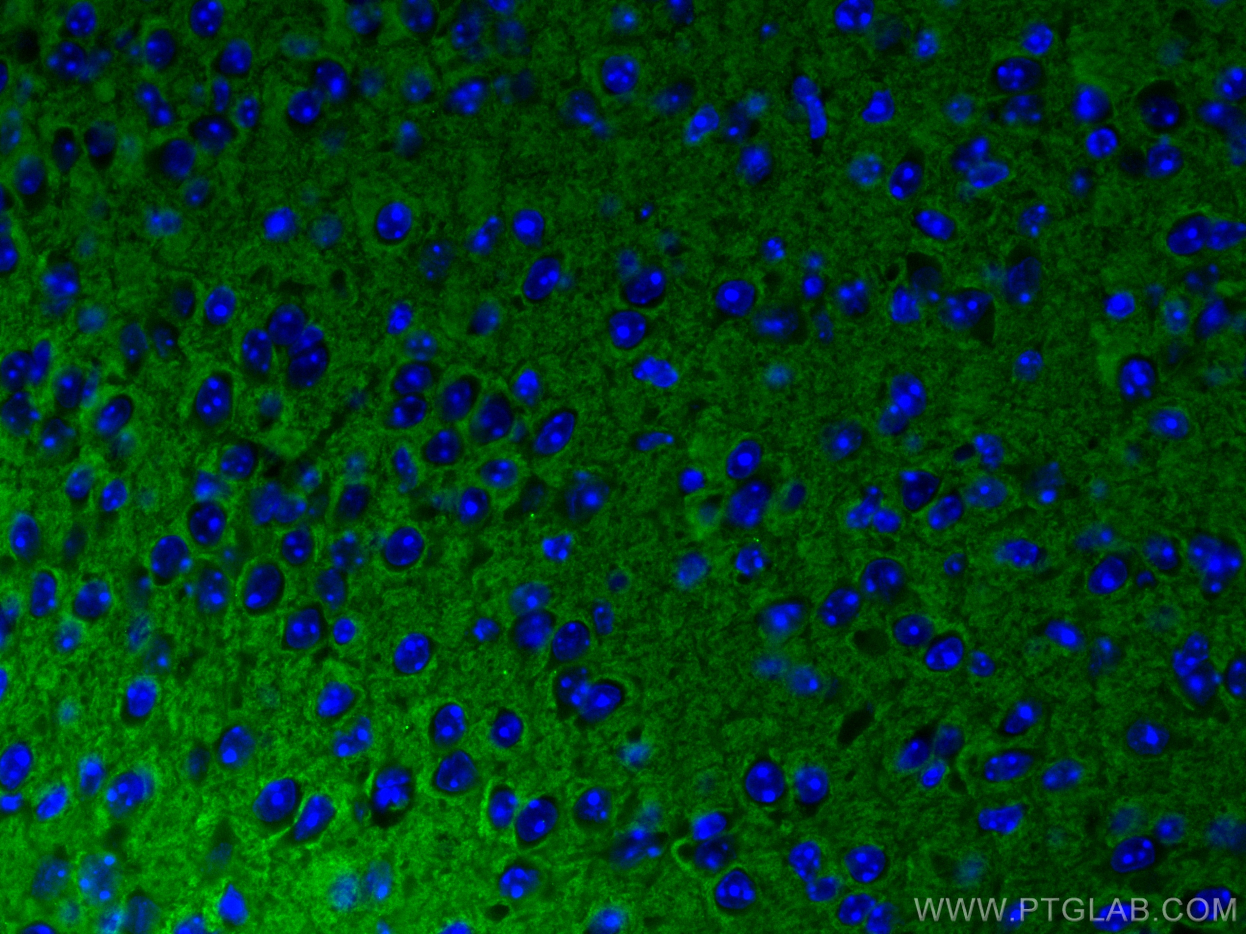 IF Staining of mouse brain using 66437-1-Ig