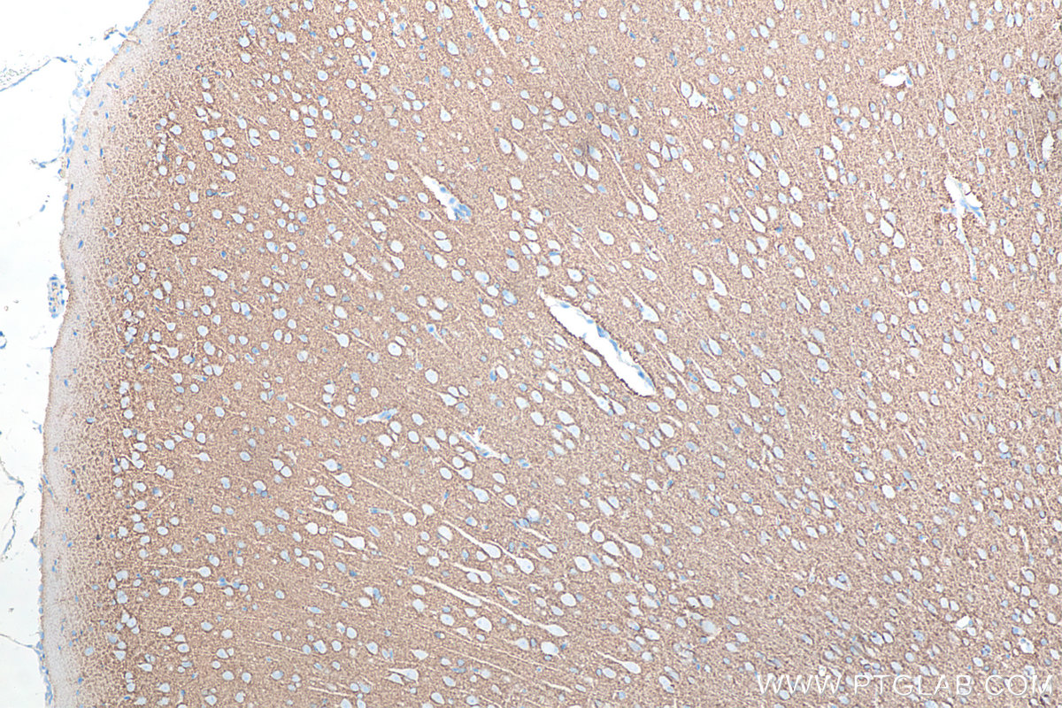 IHC staining of rat brain using 66437-1-Ig