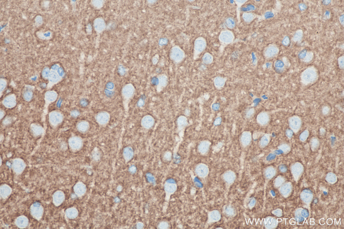 IHC staining of rat brain using 66437-1-Ig