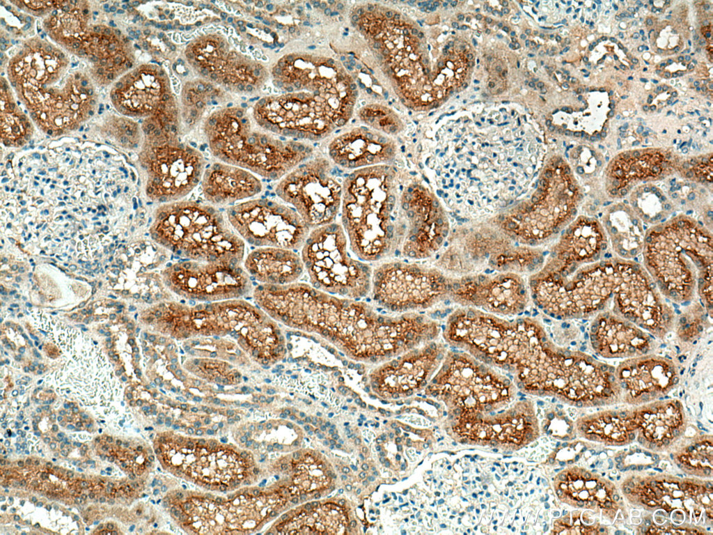 IHC staining of human kidney using 15556-1-AP