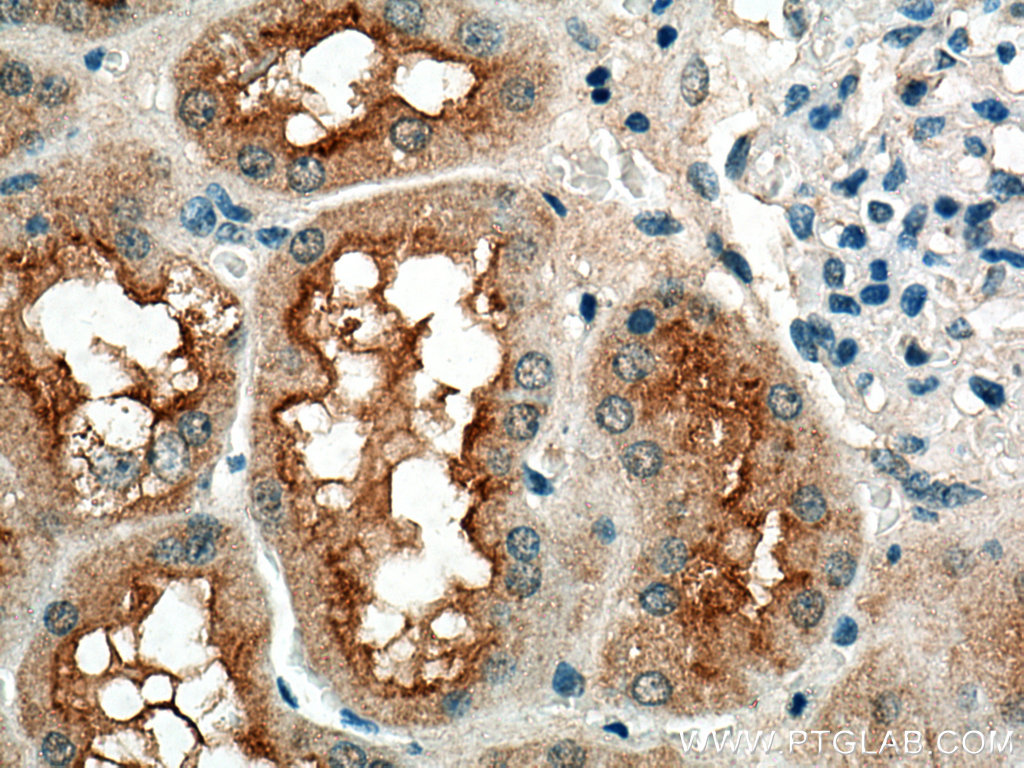 IHC staining of human kidney using 15556-1-AP