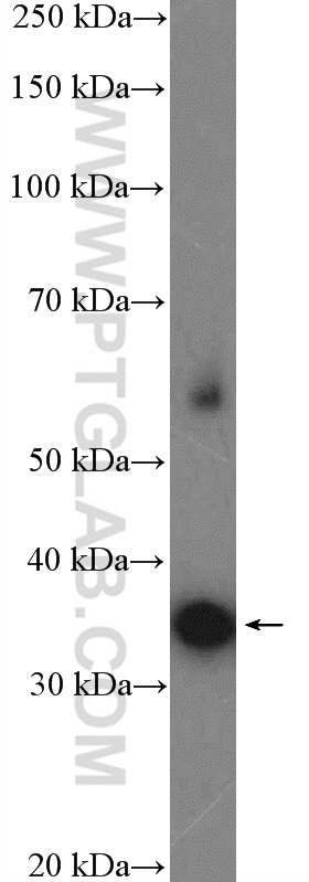 WB analysis of SH-SY5Y using 15556-1-AP