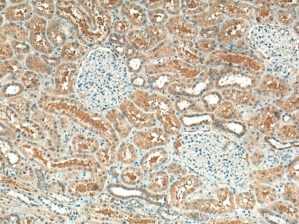 IHC staining of human kidney using 66760-1-Ig (same clone as 66760-1-PBS)