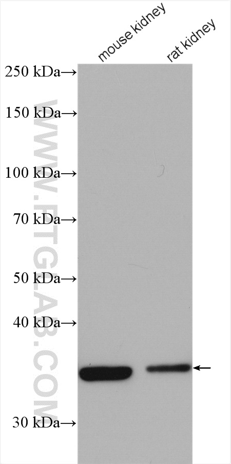 WB analysis using 14988-1-AP