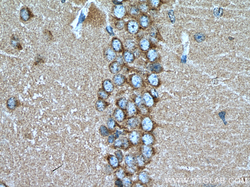 IHC staining of mouse brain using 10841-1-AP