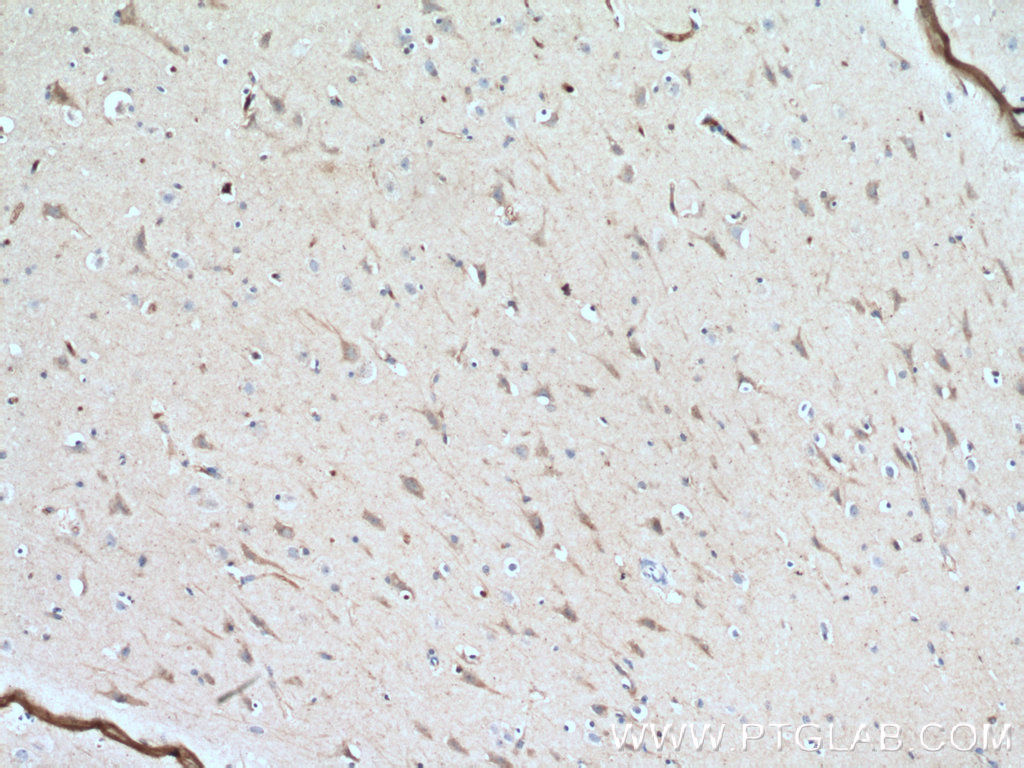 IHC staining of human brain using 60059-1-Ig