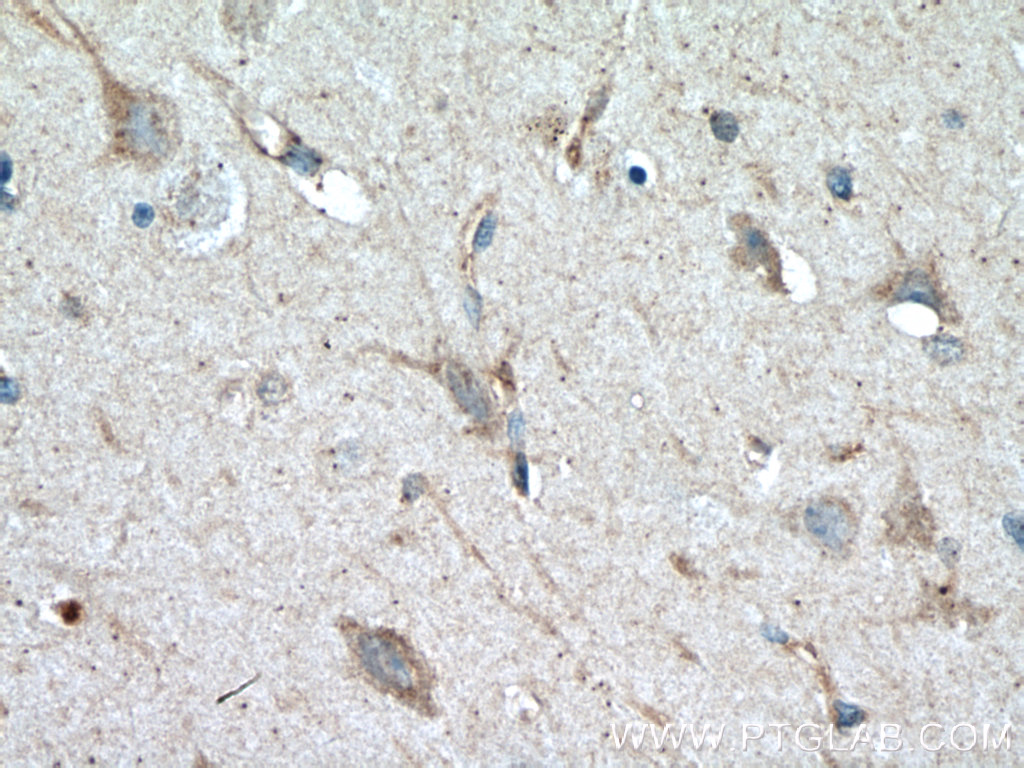 IHC staining of human brain using 60059-1-Ig