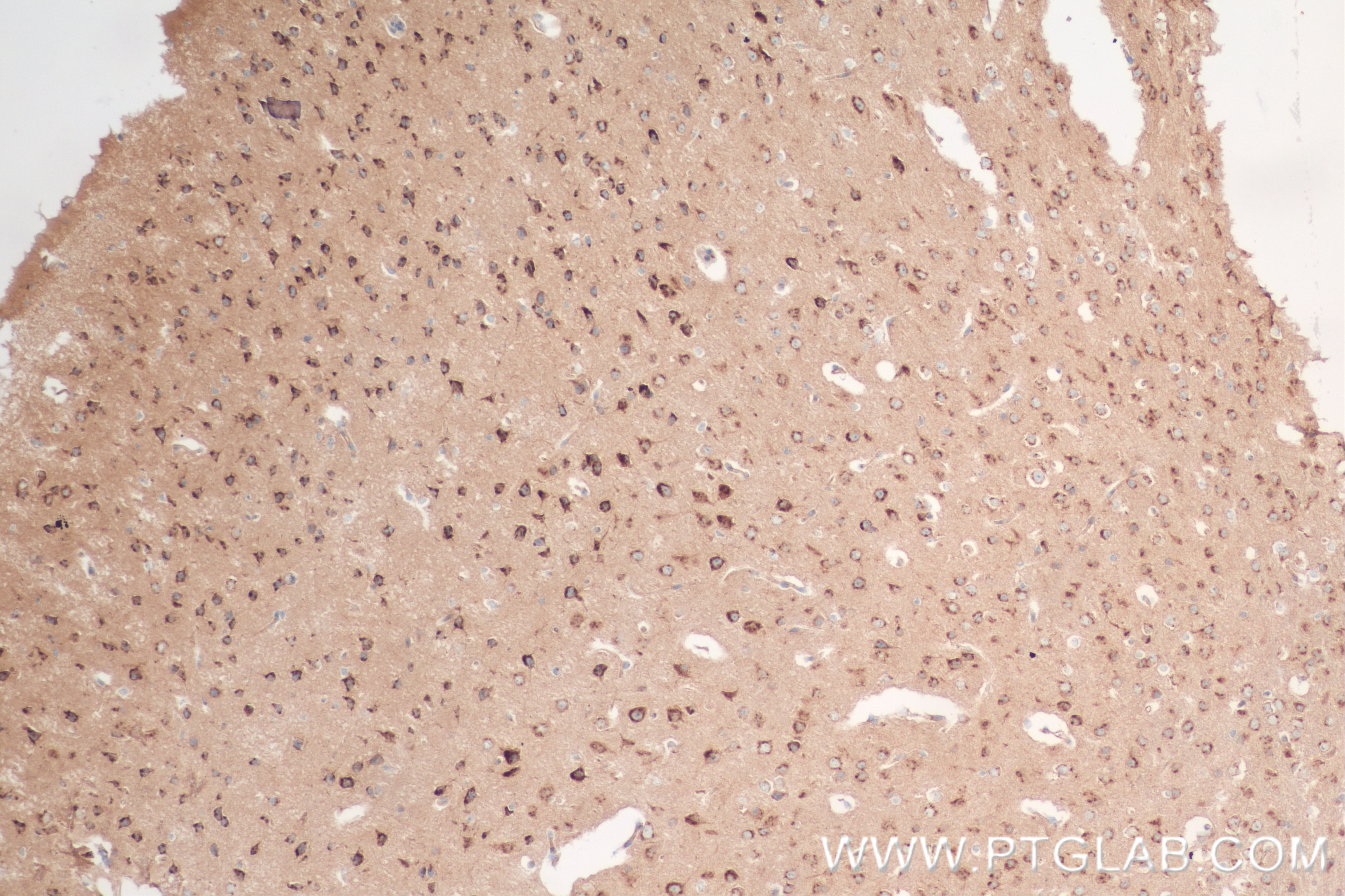 IHC staining of mouse brain using 84627-5-RR