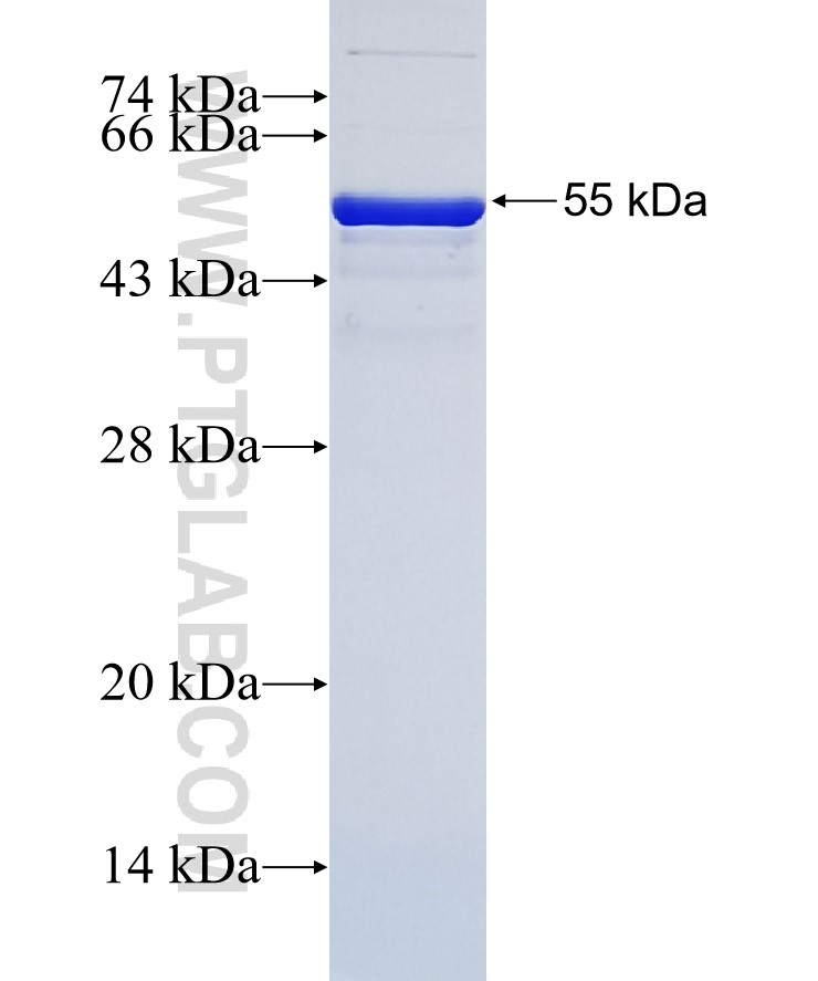 STX6 fusion protein Ag1284 SDS-PAGE
