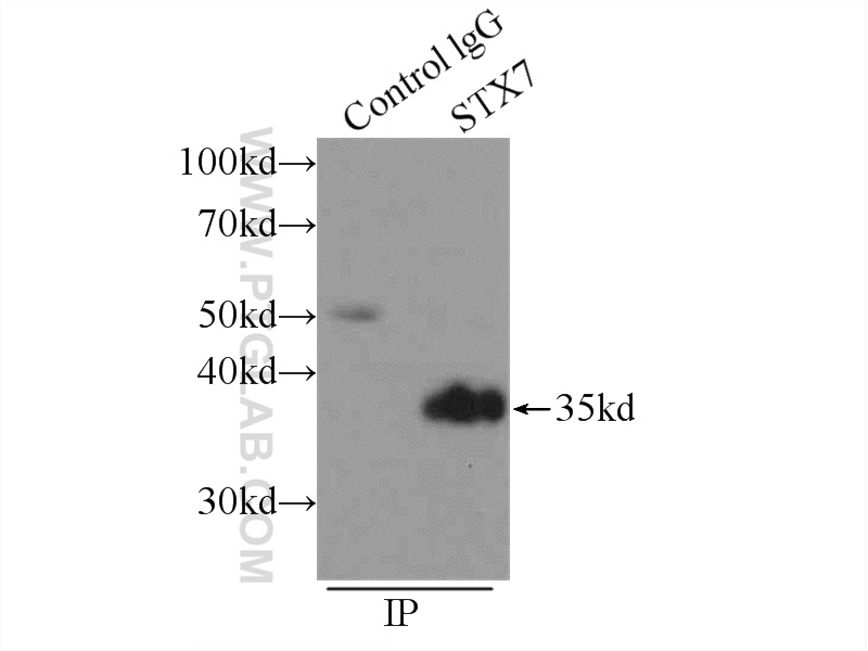 IP experiment of mouse heart using 12322-1-AP