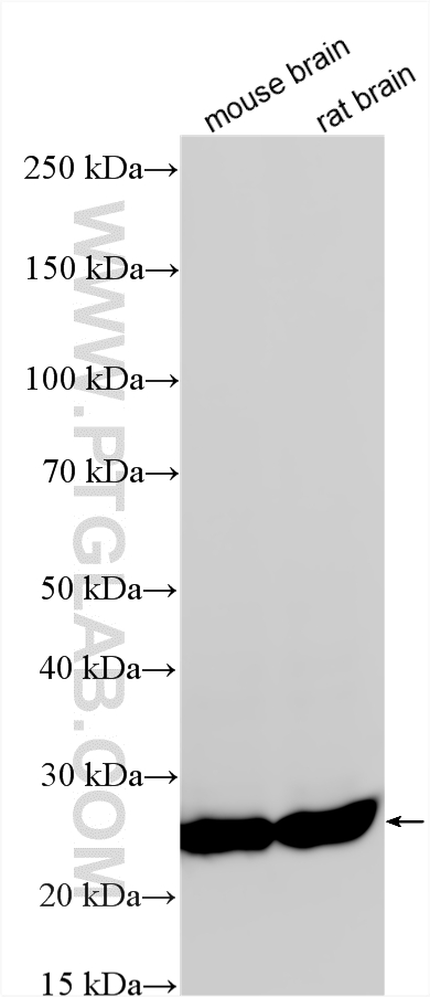 WB analysis using 12206-1-AP WB analysis using 12206-1-AP