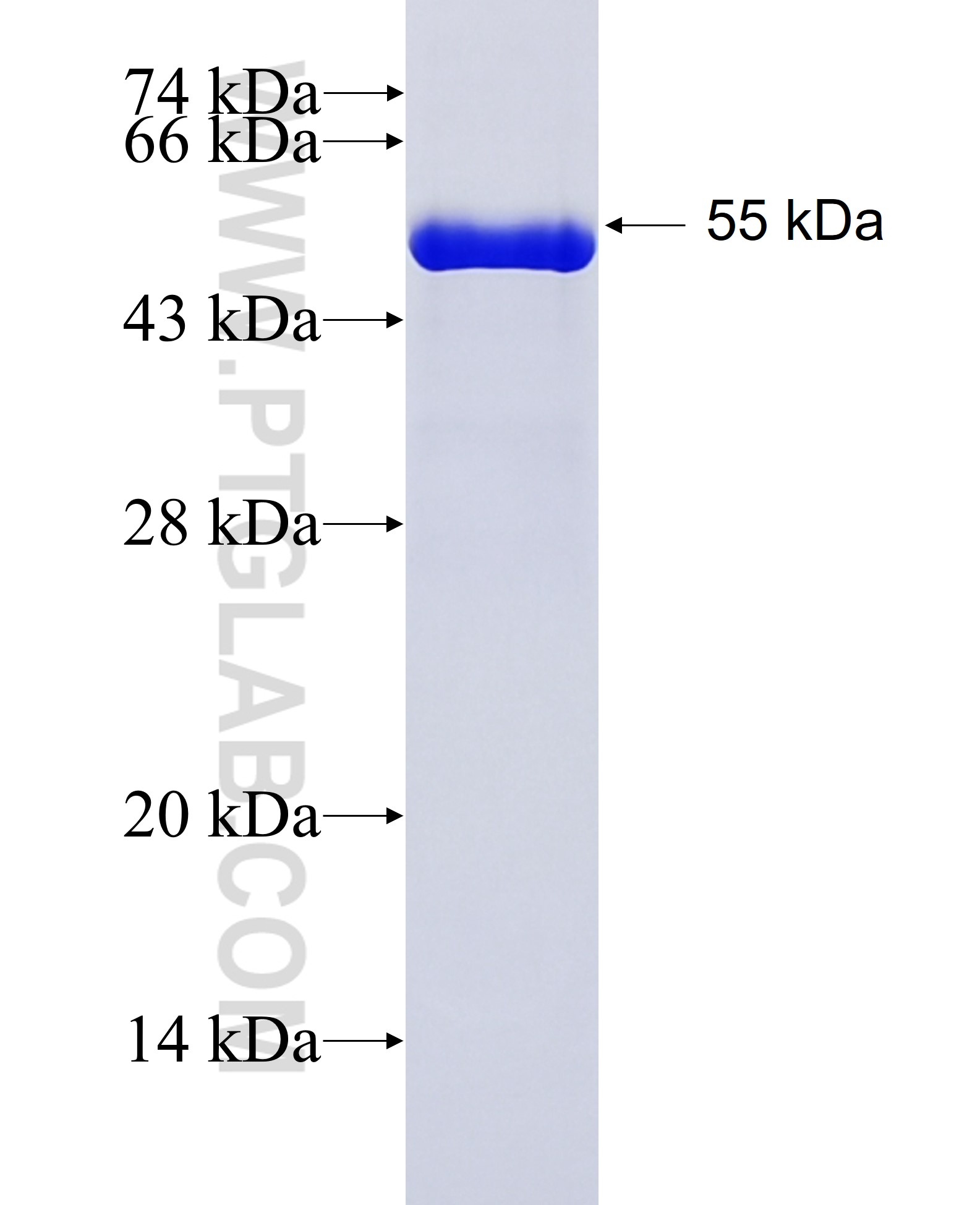 STX8 fusion protein Ag2850 SDS-PAGE