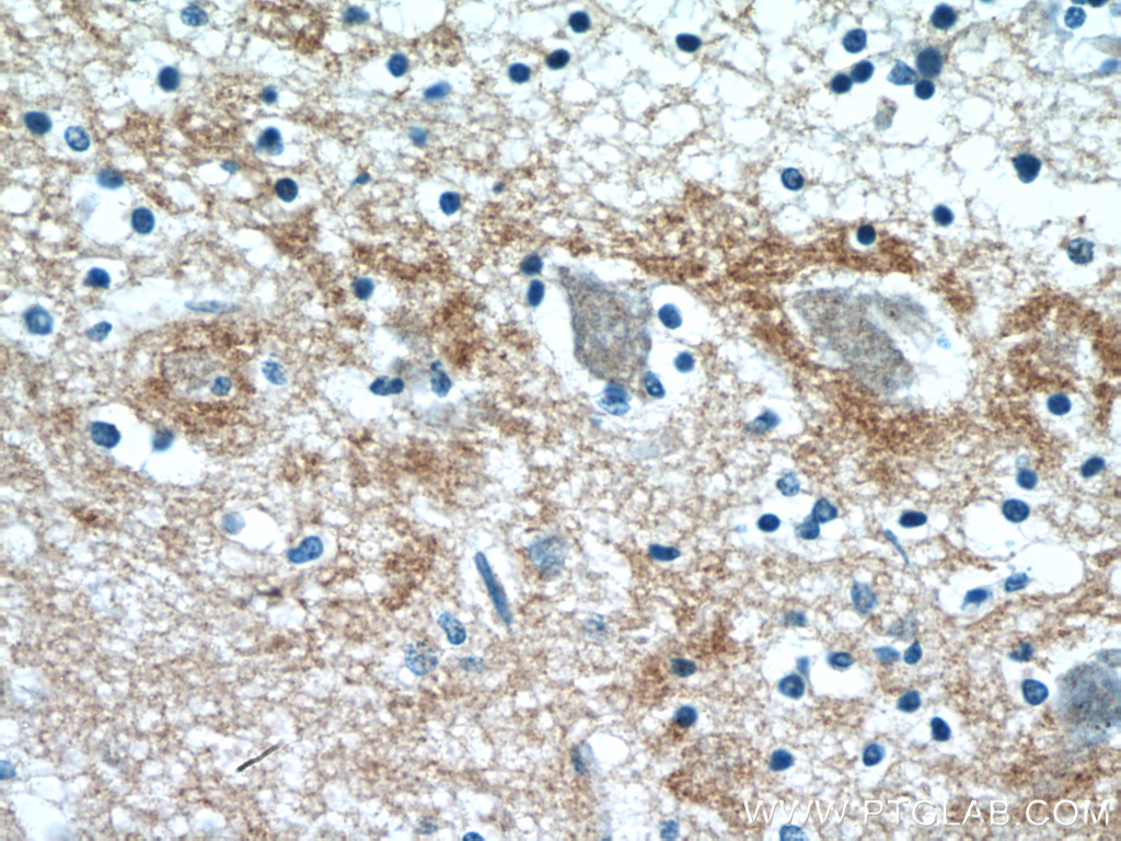 IHC staining of human brain using 11459-1-AP