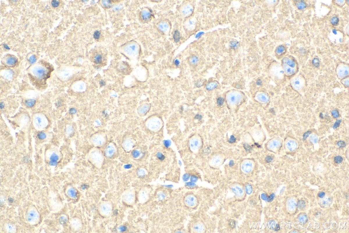 Immunohistochemical analysis of paraffin-embedded mouse brain tissue slide using 11459-1-AP (STXBP1 antibody) at dilution of 1:200 (under 40x lens). Heat mediated antigen retrieval with Tris-EDTA buffer (pH 9.0). IHC staining of mouse brain using 11459-1-AP
