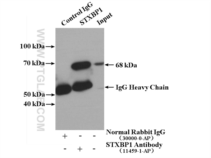 IP experiment of HeLa using 11459-1-AP