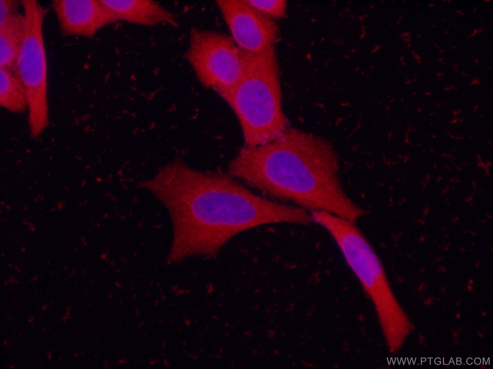 IF Staining of HeLa using 20562-1-AP