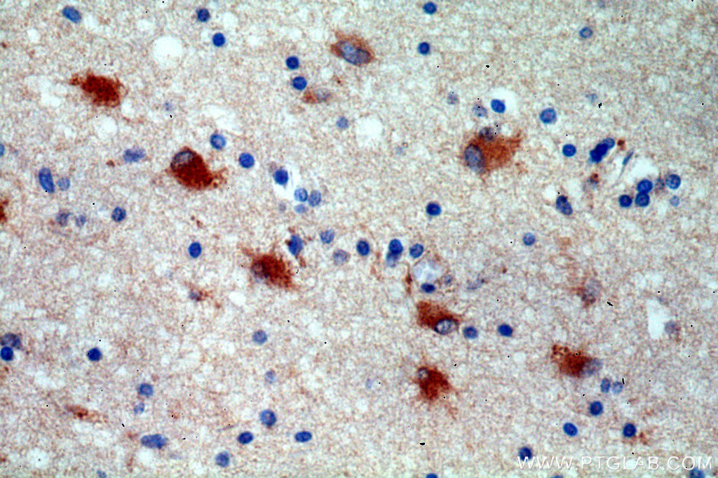 IHC staining of human brain using 20562-1-AP