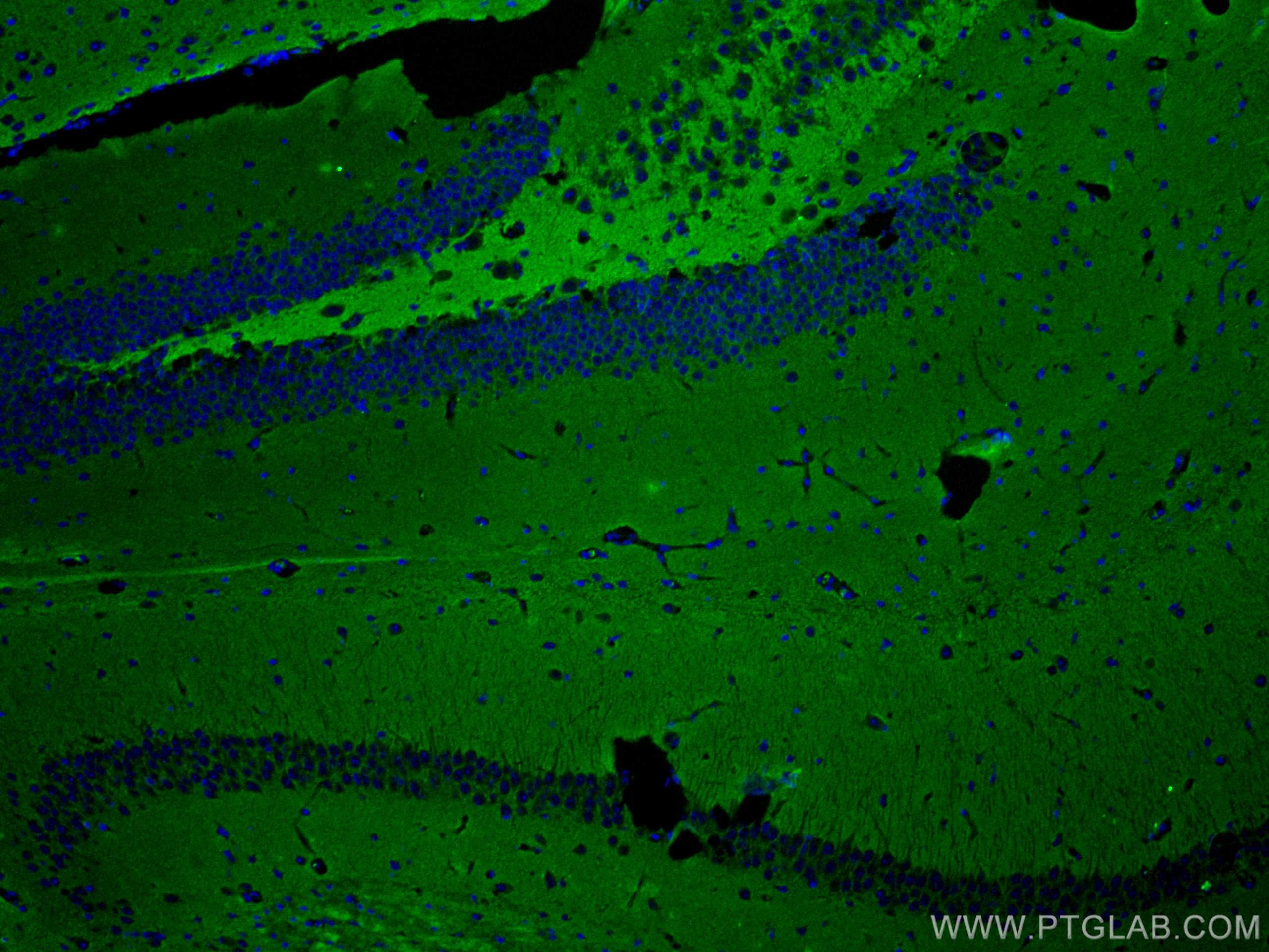 IF Staining of mouse brain using 67137-1-Ig