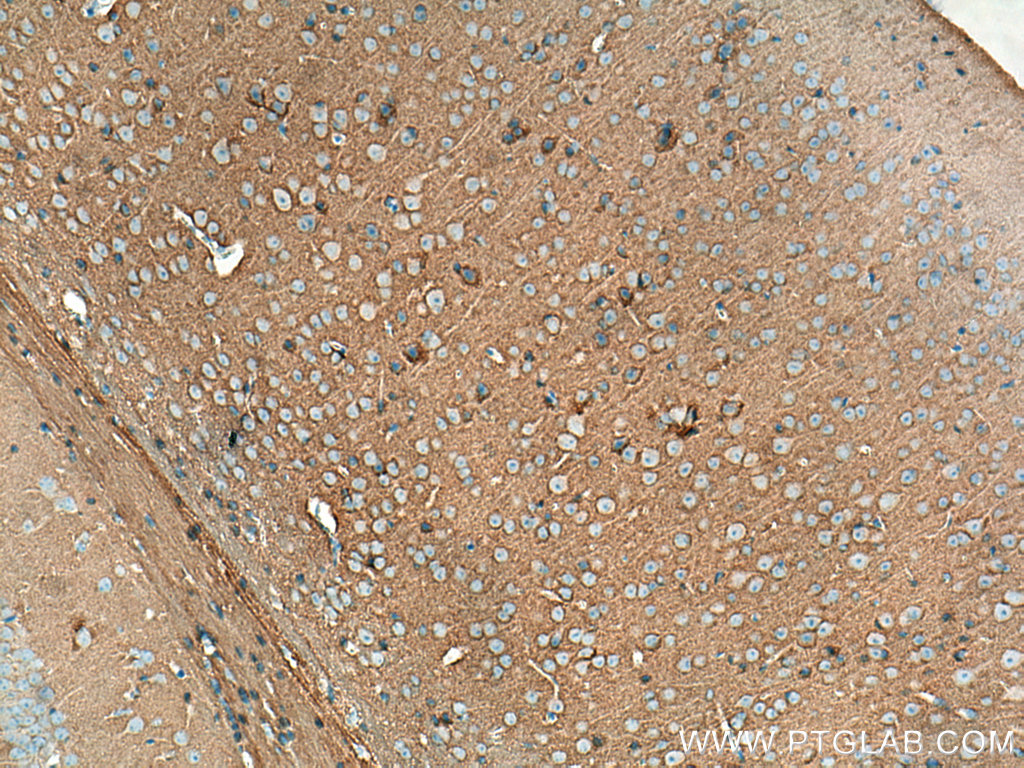 IHC staining of mouse brain using Biotin-11459