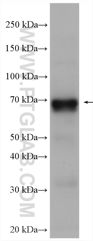 WB analysis of Y79 using Biotin-11459