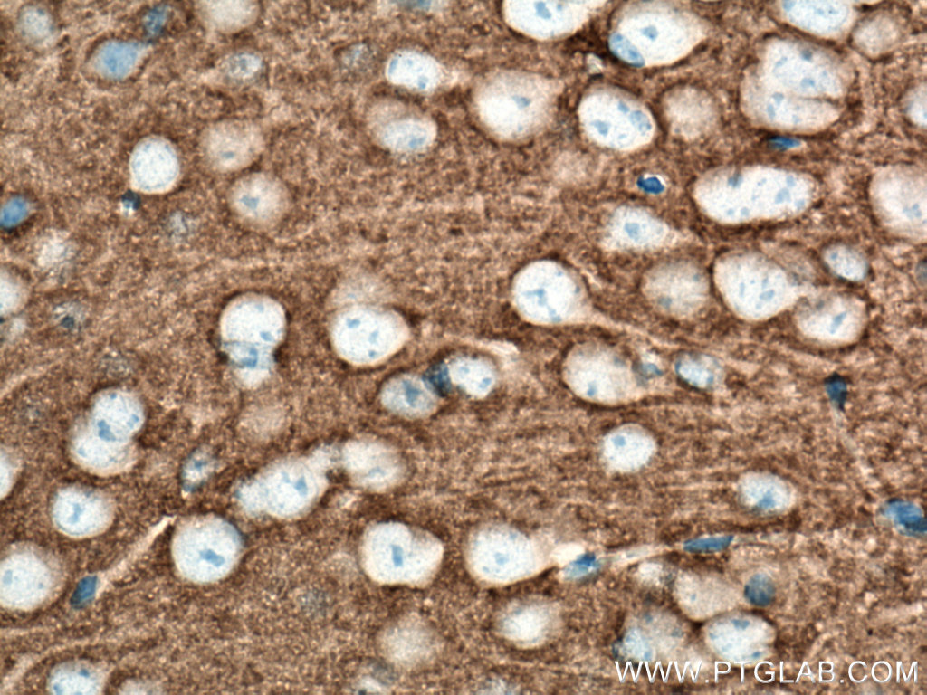 IHC staining of mouse brain using 66238-1-Ig (same clone as 66238-1-PBS)