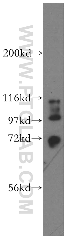 WB analysis of HepG2 using 13764-1-AP