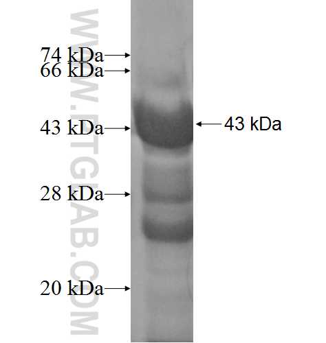 STXBP3 fusion protein Ag4738 SDS-PAGE STXBP3 fusion protein Ag4738 SDS-PAGE