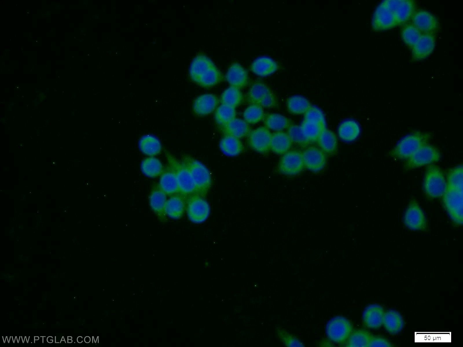 IF Staining of BxPC-3 using 14231-1-AP